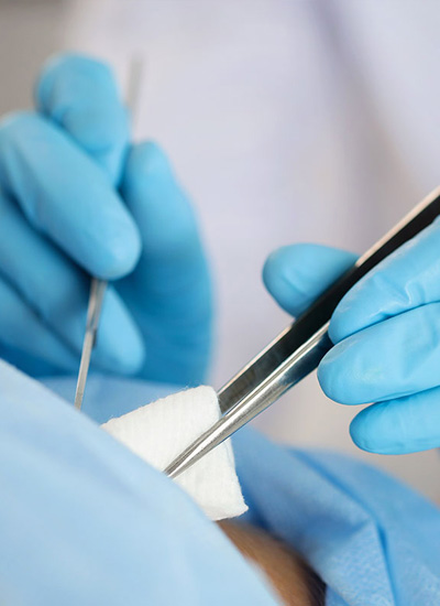 Minor Surgical Procedures